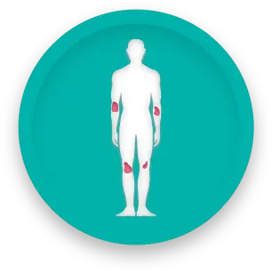 Human figure with moderate plaque psoriasis